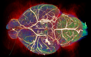 Your Unbelievable Brain: Wine, Sleep And Exercise Your Unbelievable Brain: Wine, Sleep And Exercise