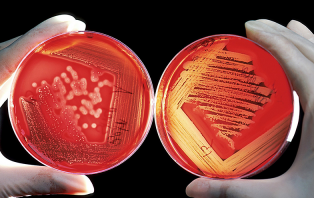 Predicting Pandemics Predicting Pandemics